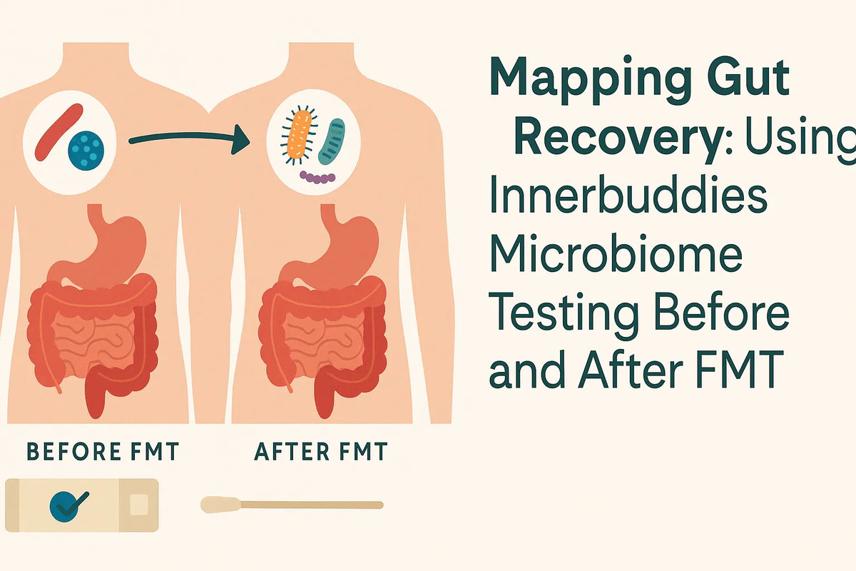 Mapping Gut Recovery: Using Innerbuddies Microbiome Testing Before and After FMT