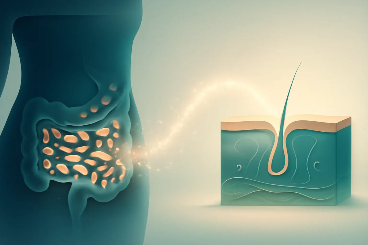microbiome and psoriasis